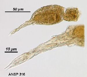  Image courtesy of ANSP (Jersabek et al. 2003) <a href='../../Reference/Index/15798' target='_blank'>[Ref.15798]</a>; female, lateral view; foot and toes shown in more detail